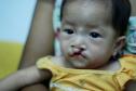 Latest Photo by Children's Surgical Centre                                 