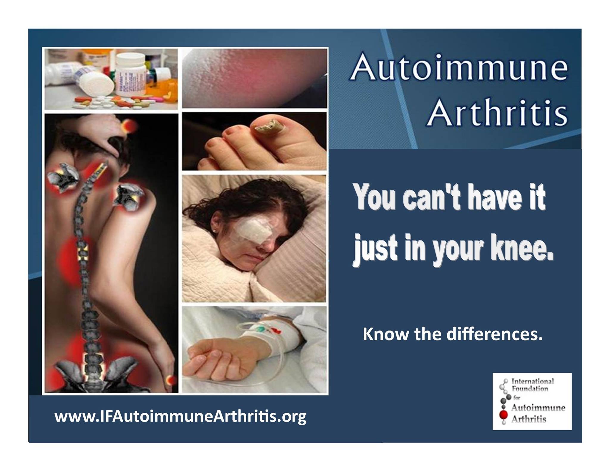 International Foundation for Autoimmune Arthritis nonprofit in ST