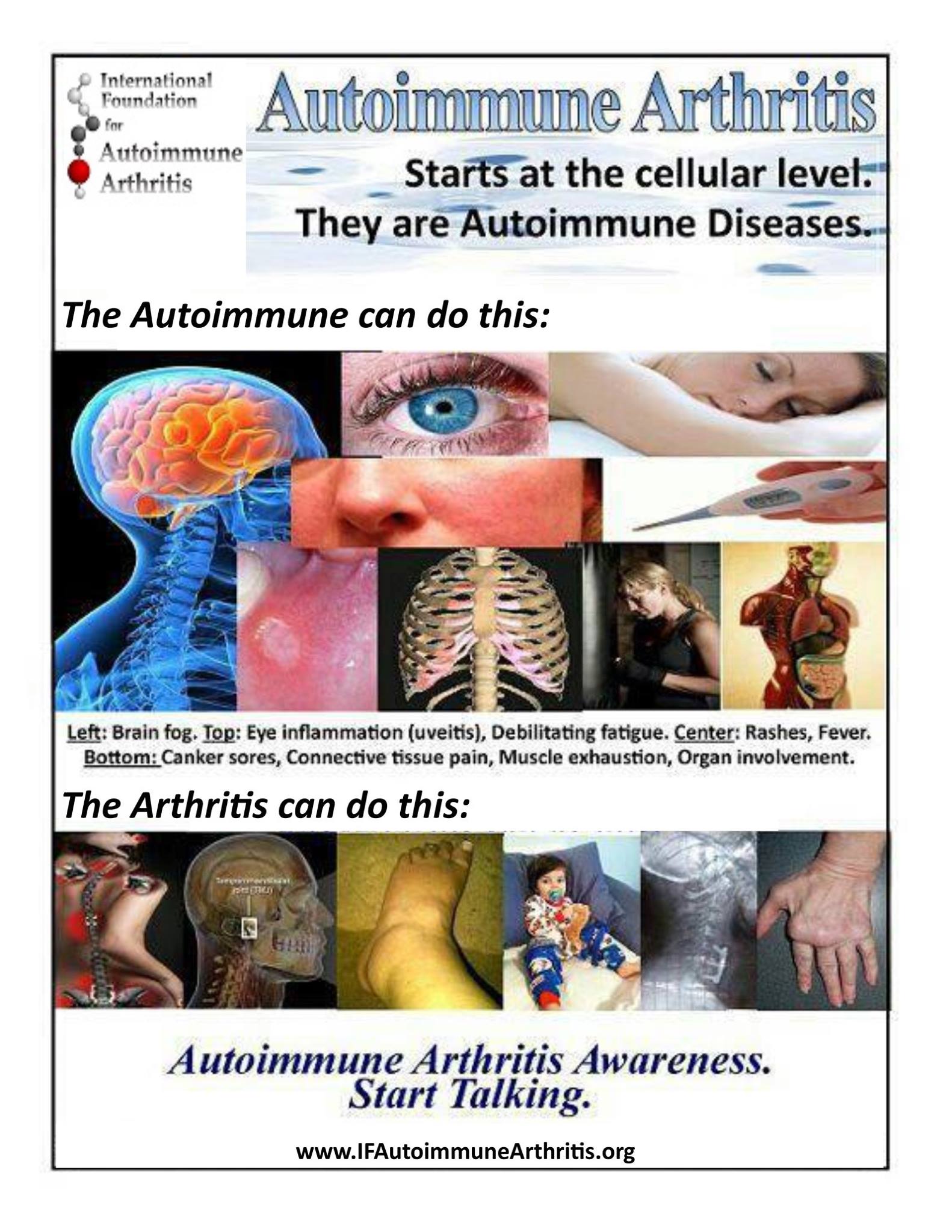 International Foundation for Autoimmune Arthritis Reviews and Ratings